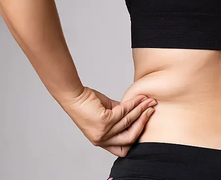 Fat Deposits on the Abdomen and Sides: Causes and How to Get Rid of Them